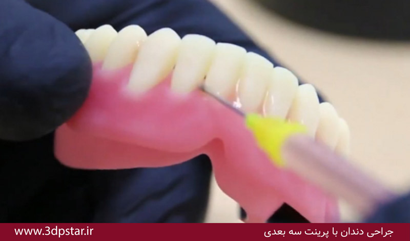 جراحی دندان با پرینتر سه بعدی