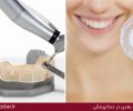 کاربردهای پرینتر های سه بعدی در دندانپزشکی
